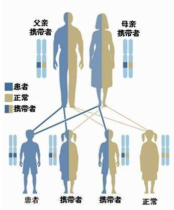 【试管孕育知识】在我们身边最常见的遗传疾病，你知道哪些?