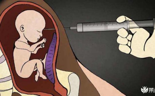 人工流产后多久能洗头?